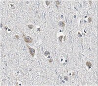 Anti-Sortilin Antibody, clone F11 | MABN1792